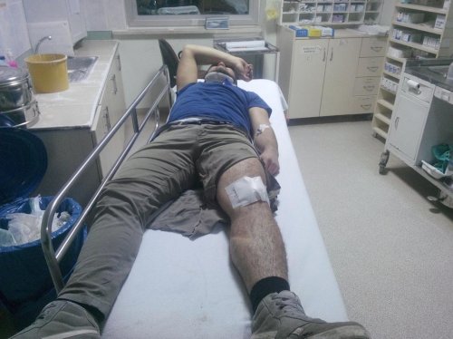 Merzifon'da motosiklet devrildi: 1 yaralı