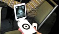 'Cep' büyüklüğünde ultrason cihazı