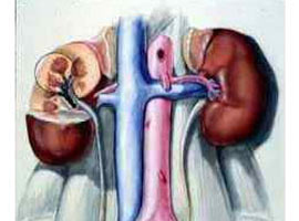 Erkeklerin böbrekleri daha çok taş yapıyor  