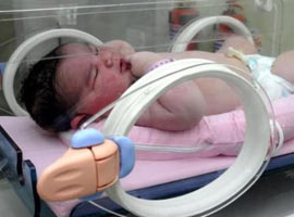 7 kilo 100 gram doğdu !