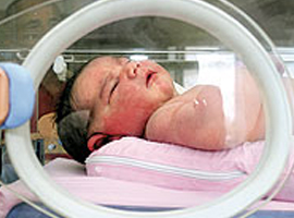 Merve bebeği ölünce görebildi