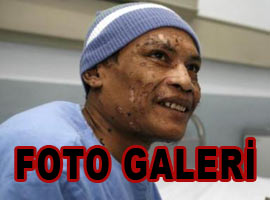 İşte 'Ağaç Adam'ın son hali - Galeri