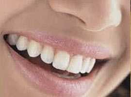 Ramazan'da ağız kokusu istemiyorsanız...