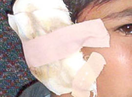 Belediye Başkanı kulak kopardı !