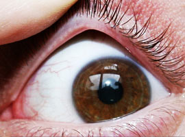 Gözlerinizi kaşıyıp ovuşturmayın!