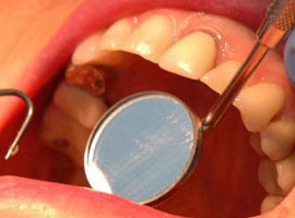 Yanlış diş ipi kullanımına dikkat!