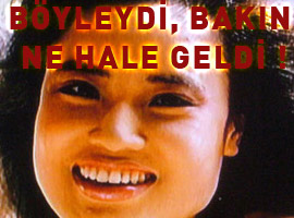 Güzelleşmek uğruna ne hale geldi ! - Foto