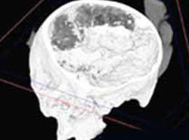 En eski insan beyni bulundu