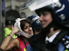 G20 zirvesinde kan aktı