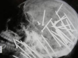 Böyle vahşet görülmedi !