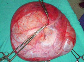 Doktorları <b>şaşırtan kitle</b> !