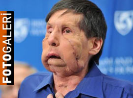 Görenler hayrete düşüyor ! - Foto