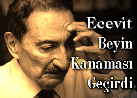 Ecevit beyin kanaması geçirdi