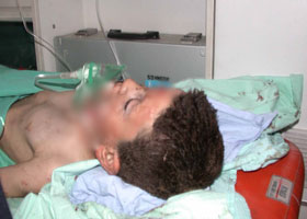 Şırnak'ta mayın faciası: 2 çocuk öldü