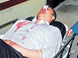 Cihan muhabiri kazadan yaralı kurtuldu  