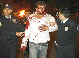 Çapan'ın trafik sicili kabarık  