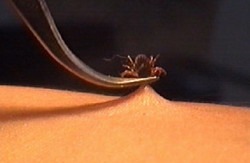 Kırıkkale'de kene paniği 