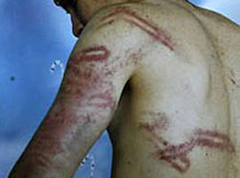 Böyle işkence görülmedi