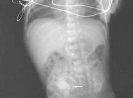 Midede 143 paket kokain