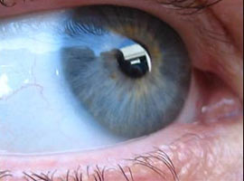 Şeker hastalığı teşhisi nasıl olur?