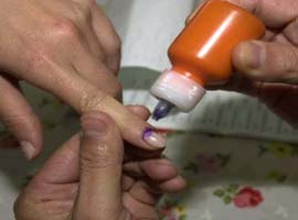 Seçim boyasını çıkarmanın yolları