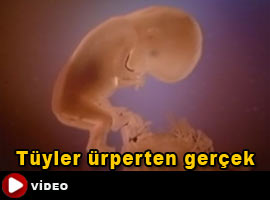 Bağımlılık, bebeğinizi öldürebilir -   Video