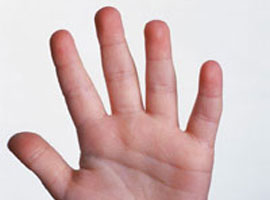 İşte parmak yapınıza göre kişiliğiniz