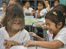 Çok farklı ama kimse dışlamıyor !